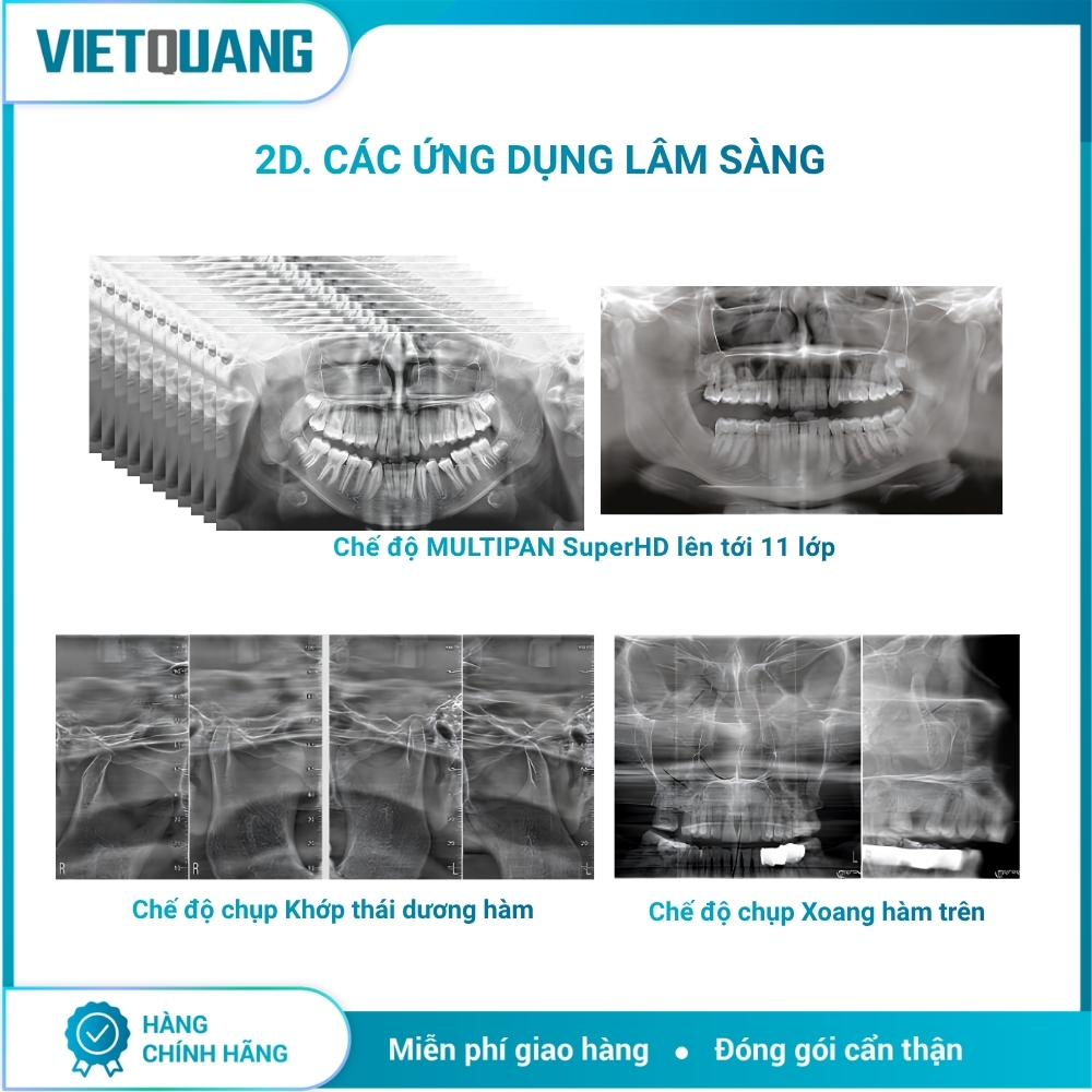 MyRay Hyperion X9 Pro – Máy chụp X-quang CBCT 2D/3D/Ceph. Máy chụp X-quang CBCT MyRay Hyperion X9 Pro tích hợp Panorama 2D, CBCT 3D và Cephalometric cho Digital Workflow nha khoa.