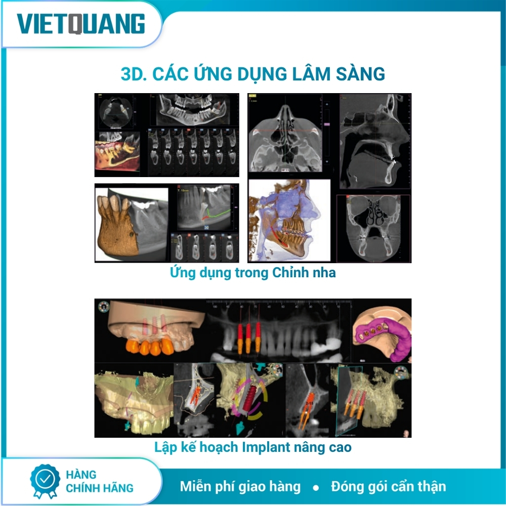 MyRay Hyperion X9 Pro – Máy chụp X-quang CBCT 2D/3D/Ceph. Máy chụp X-quang CBCT MyRay Hyperion X9 Pro tích hợp Panorama 2D, CBCT 3D và Cephalometric cho Digital Workflow nha khoa.