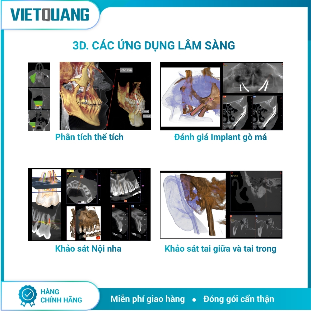 MyRay Hyperion X9 Pro – Máy chụp X-quang CBCT 2D/3D/Ceph. Máy chụp X-quang CBCT MyRay Hyperion X9 Pro tích hợp Panorama 2D, CBCT 3D và Cephalometric cho Digital Workflow nha khoa.