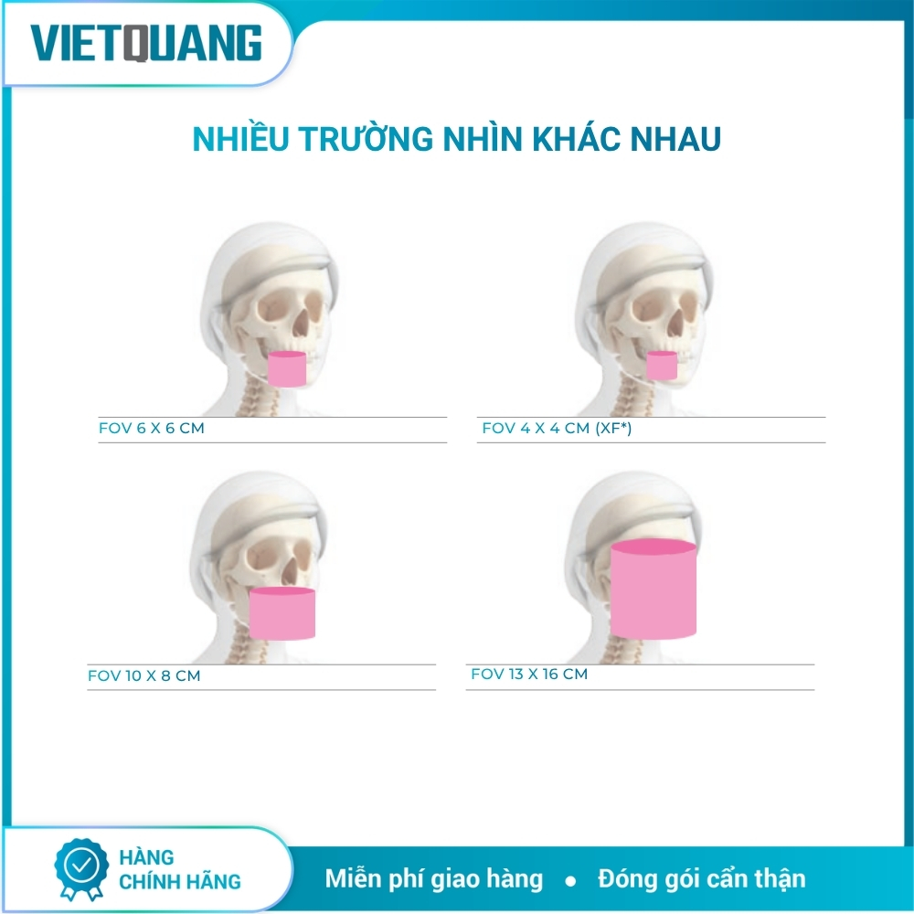 MyRay Hyperion X9 Pro – Máy chụp X-quang CBCT 2D/3D/Ceph. Máy chụp X-quang CBCT MyRay Hyperion X9 Pro tích hợp Panorama 2D, CBCT 3D và Cephalometric cho Digital Workflow nha khoa.