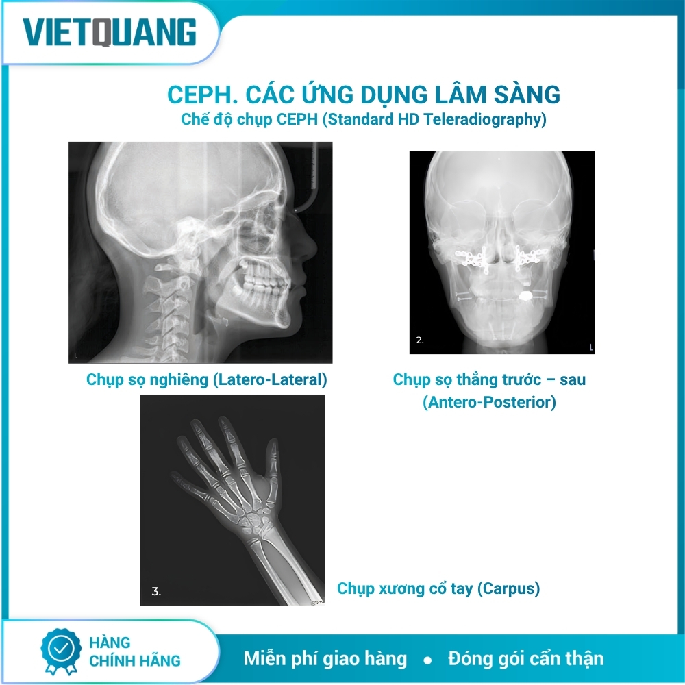 MyRay Hyperion X9 Pro – Máy chụp X-quang CBCT 2D/3D/Ceph. Máy chụp X-quang CBCT MyRay Hyperion X9 Pro tích hợp Panorama 2D, CBCT 3D và Cephalometric cho Digital Workflow nha khoa.