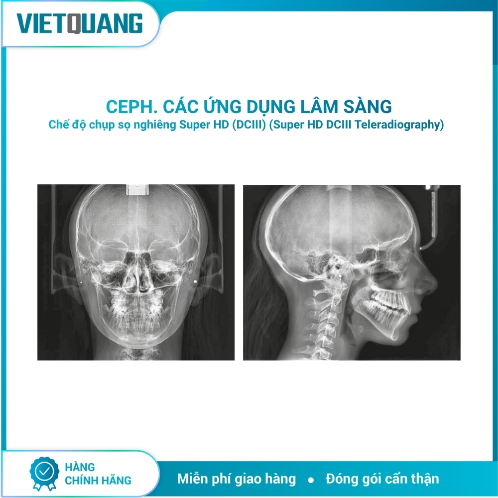 MyRay Hyperion X9 Pro – Máy chụp X-quang CBCT 2D/3D/Ceph. Máy chụp X-quang CBCT MyRay Hyperion X9 Pro tích hợp Panorama 2D, CBCT 3D và Cephalometric cho Digital Workflow nha khoa.