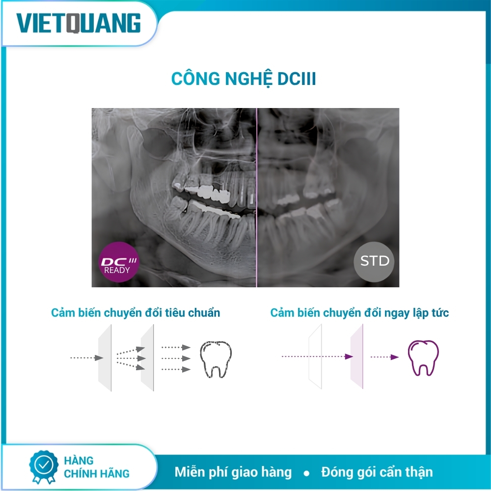 MyRay Hyperion X9 Pro – Máy chụp X-quang CBCT 2D/3D/Ceph. Máy chụp X-quang CBCT MyRay Hyperion X9 Pro tích hợp Panorama 2D, CBCT 3D và Cephalometric cho Digital Workflow nha khoa.