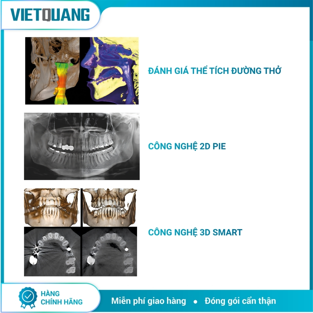 MyRay Hyperion X9 Pro – Máy chụp X-quang CBCT 2D/3D/Ceph. Máy chụp X-quang CBCT MyRay Hyperion X9 Pro tích hợp Panorama 2D, CBCT 3D và Cephalometric cho Digital Workflow nha khoa.