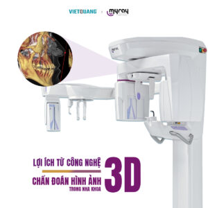 loi ich tu chan doan hinh anh 3d trong nha khoa