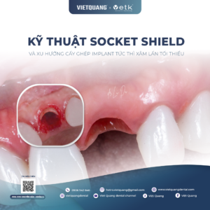 socket shield