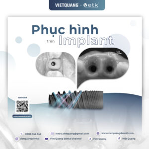 phục hình