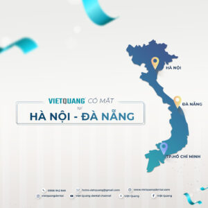 việt quang