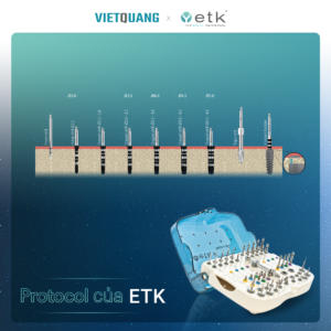 implant ETK pháp
