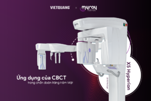 cbct