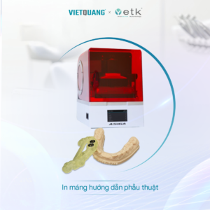 KỸ THUẬT SỐ TRONG CẤY GHÉP IMPLANT