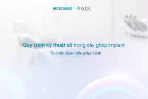 KỸ THUẬT SỐ TRONG CẤY GHÉP IMPLANT