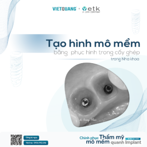 tạo hình mô mềm