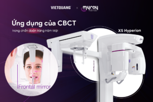 CBCT