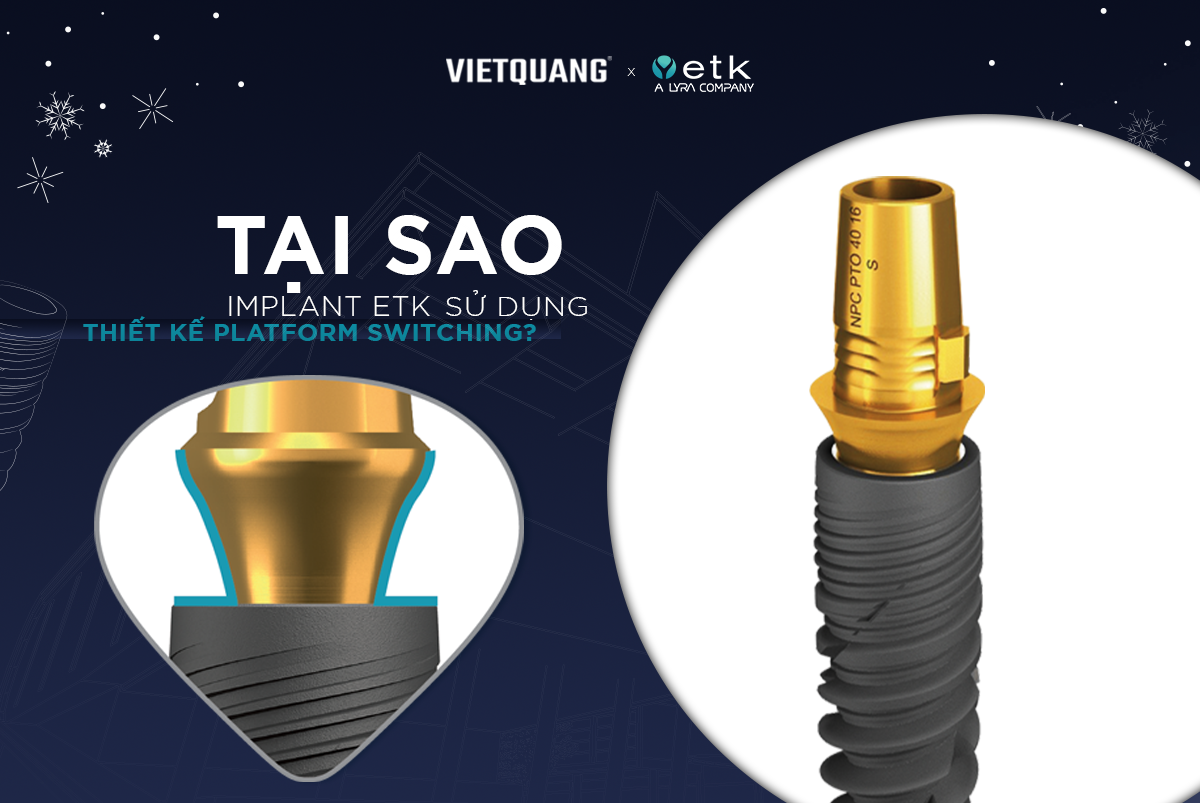 [ETK] #2 TẠI SAO IMPLANT ETK SỬ DỤNG THIẾT KẾ PLATFORM SWITCHING ...