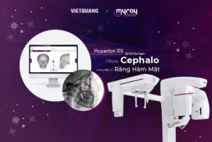 PHIM CHỤP CEPHALO