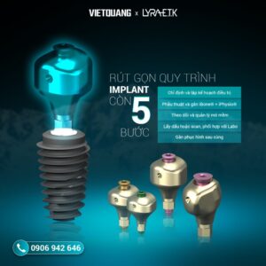 iPhysio Profile Designer 3-in-1 trong quy trình phục hình Implant