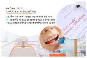 luu y khi nieng rang