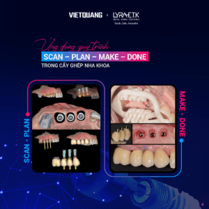 Quy trình SCAN – PLAN – MAKE – DONE giúp rút ngắn thời gian điều trị và nâng cao trải nghiệm bệnh nhân