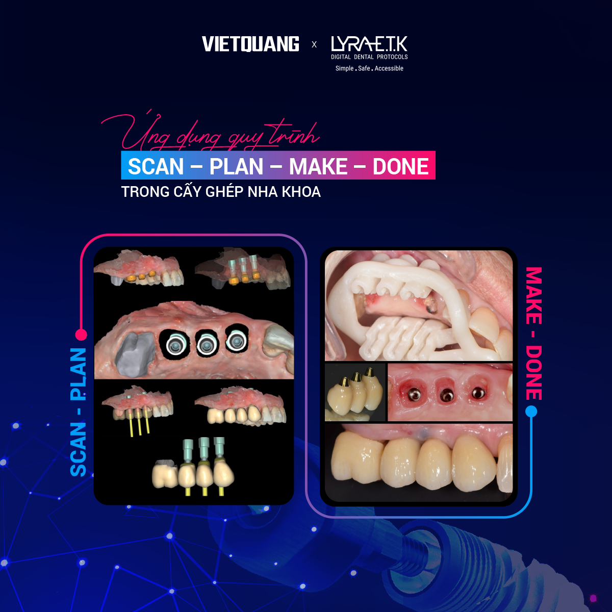 Quy trình SCAN – PLAN – MAKE – DONE giúp rút ngắn thời gian điều trị và nâng cao trải nghiệm bệnh nhân