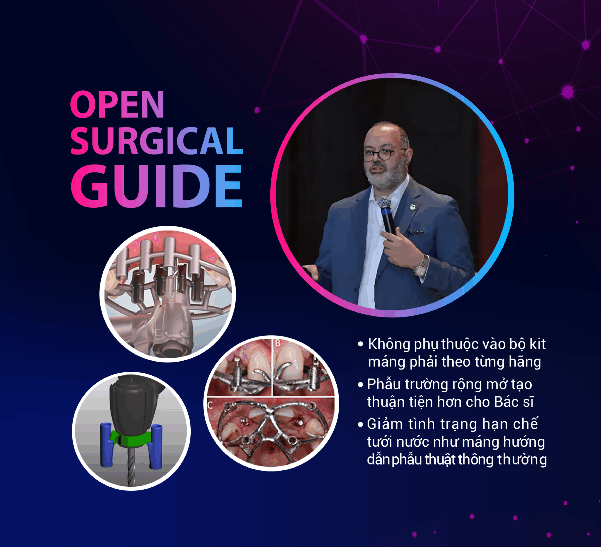 Chương trình Seminar của Việt Quang sẽ chia sẻ về Open Surgical Guide – máng phẫu thuật kỹ thuật số độc đáo