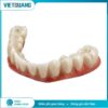 Phôi zirconia Aconia HT+ White dùng trong chế tác phục hình răng sứ CAD/CAM tại Labo nha khoa.