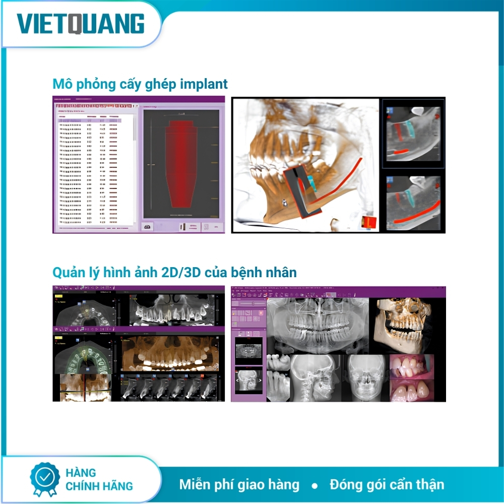 Máy chụp X-quang CBCT MyRay Hyperion X5 Máy chụp X-quang CBCT MyRay Hyperion X5