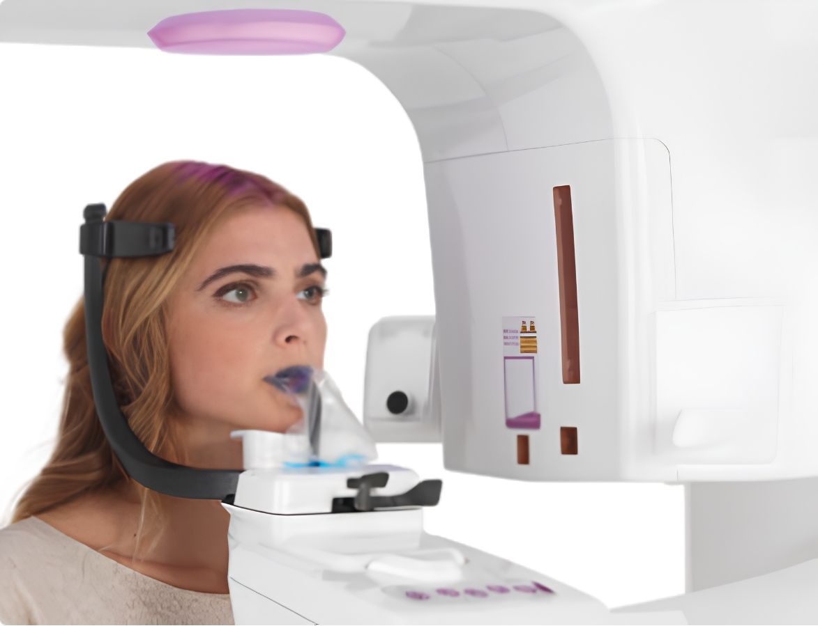 CBCT Hyperion X9 Pro FullView MyRay chụp Panorama và CBCT 3D
