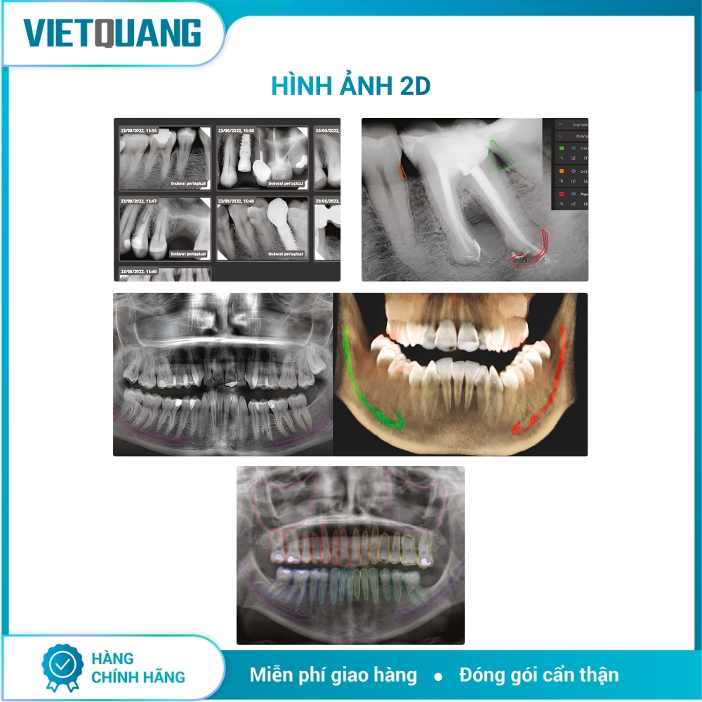 CBCT Hyperion X9 Pro FullView – MyRay CBCT Hyperion X9 Pro FullView MyRay chụp Panorama và CBCT 3D