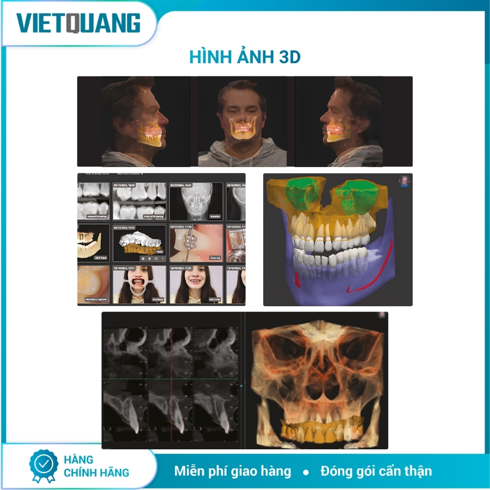 CBCT Hyperion X9 Pro FullView – MyRay CBCT Hyperion X9 Pro FullView MyRay chụp Panorama và CBCT 3D