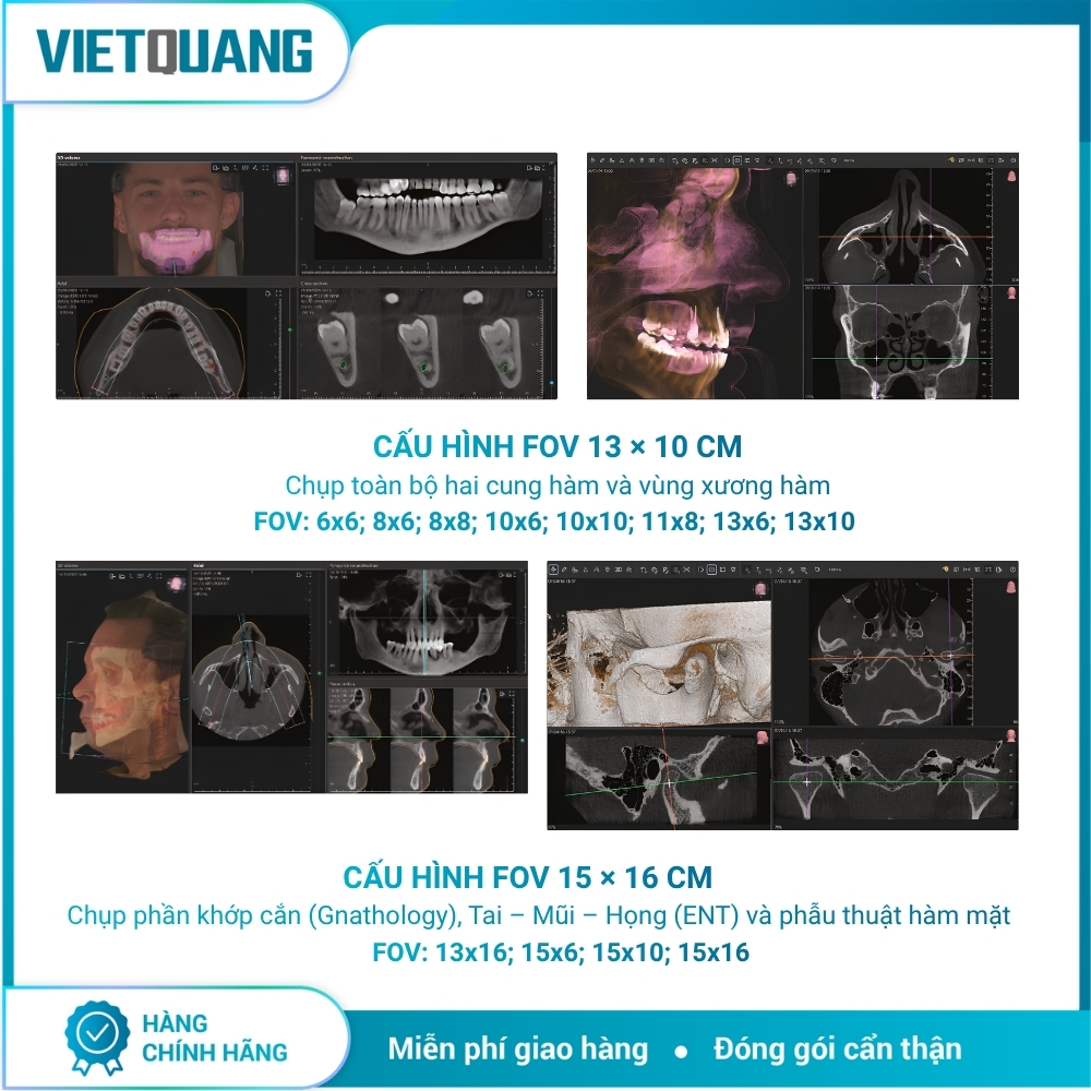 CBCT Hyperion X9 Pro FullView – MyRay CBCT Hyperion X9 Pro FullView MyRay chụp Panorama và CBCT 3D