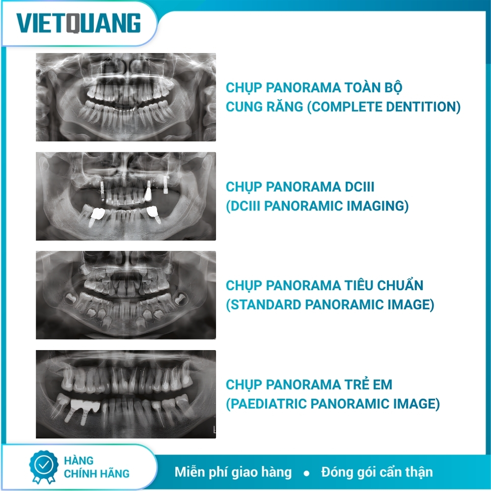 CBCT Hyperion X9 Pro FullView – MyRay CBCT Hyperion X9 Pro FullView MyRay chụp Panorama và CBCT 3D