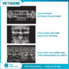 CBCT Hyperion X9 Pro FullView MyRay chụp Panorama và CBCT 3D