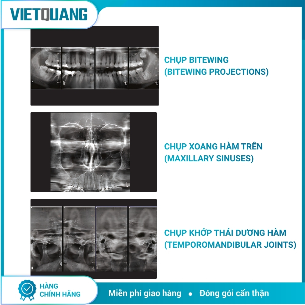CBCT Hyperion X9 Pro FullView – MyRay CBCT Hyperion X9 Pro FullView MyRay chụp Panorama và CBCT 3D