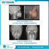 CBCT Hyperion X9 Pro FullView MyRay chụp Panorama và CBCT 3D