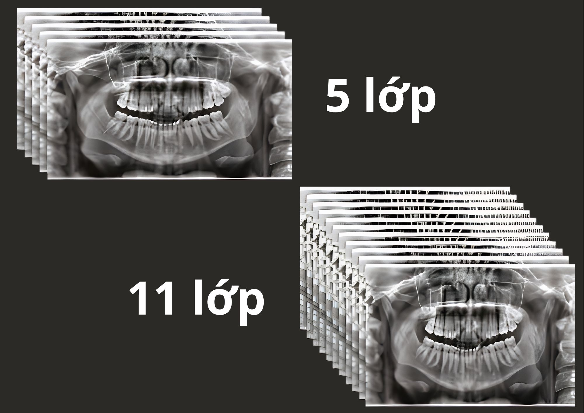 MultiPAN SuperHD trên CBCT Hyperion X9 Pro FullView với nhiều lớp lấy nét trong một lần quét